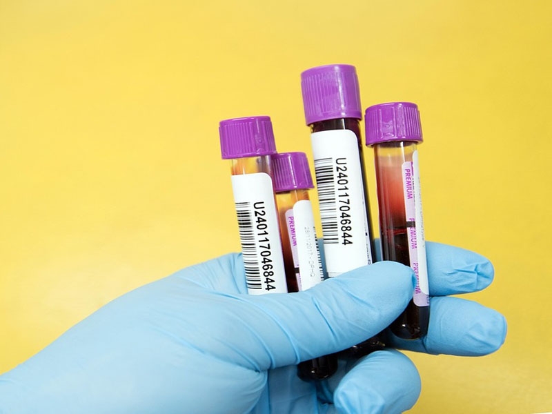 Pemeriksaan Tes Darah