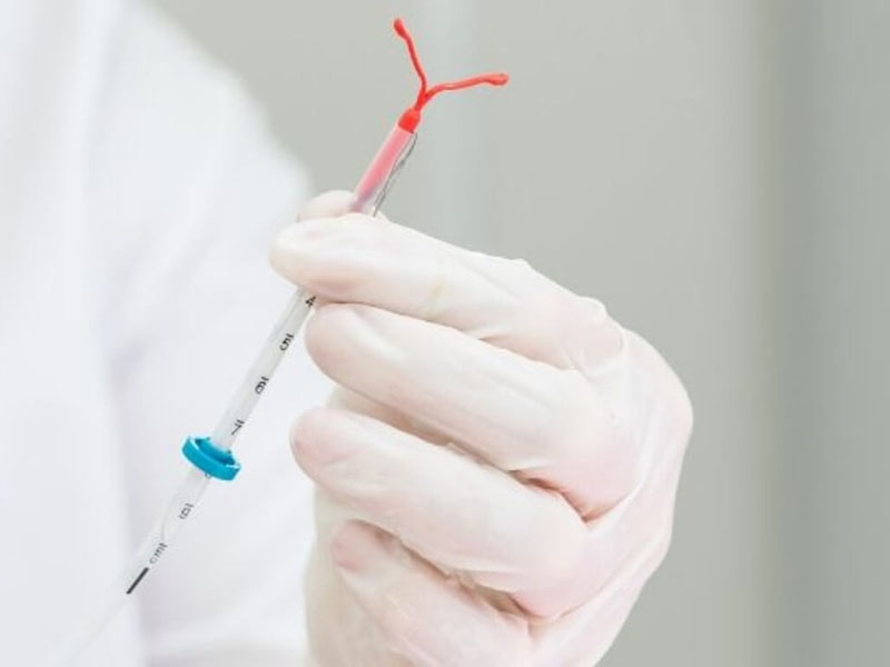 Penghapusan IUD